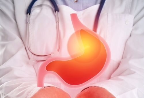 Mide Ülser Hastalığı ve Polen